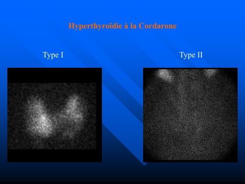 Contre-indications - sofomec