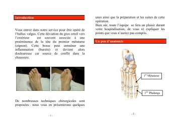 Livret information patient hallux valgus JP. Marchaland - ClubOrtho.fr