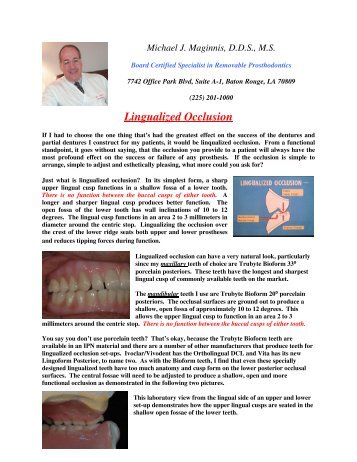 Lingualized Occlusion - ProSites