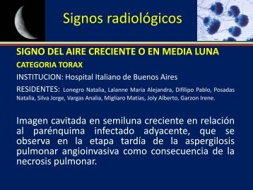 Signo del aire creciente - Congreso SORDIC