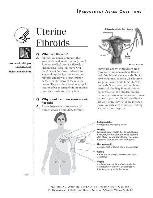 Uterine fibroids fact sheet - WomensHealth.gov