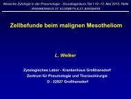 Zellbefunde beim malignen Mesotheliom - Krankenhaus St ...