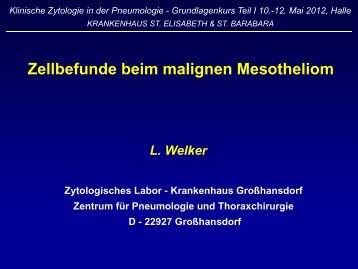 Zellbefunde beim malignen Mesotheliom - Krankenhaus St ...