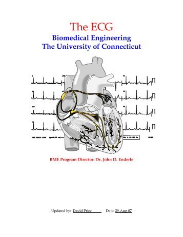 The ECG - Biomedical Engineering - University of Connecticut