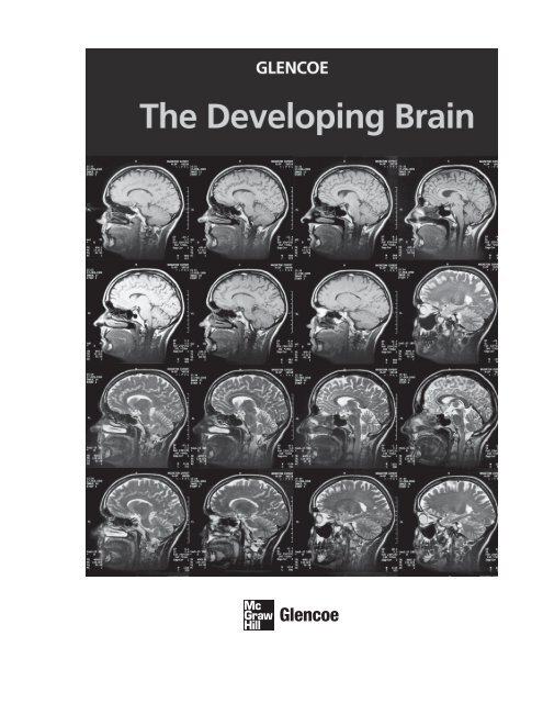 The Developing Brain (9124.0K) - McGraw-Hill Higher Education