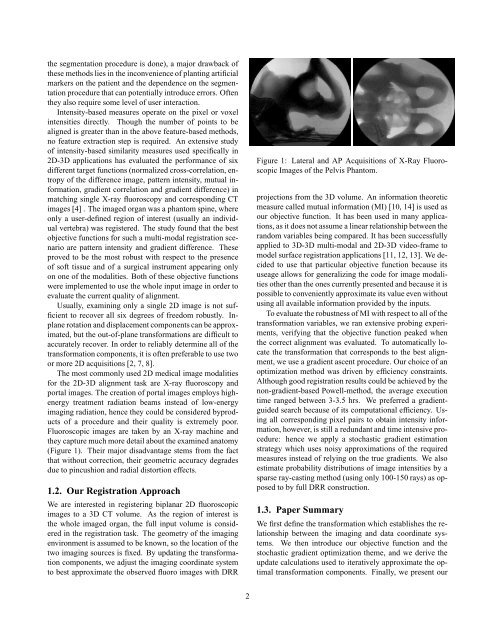 the segmentation procedur