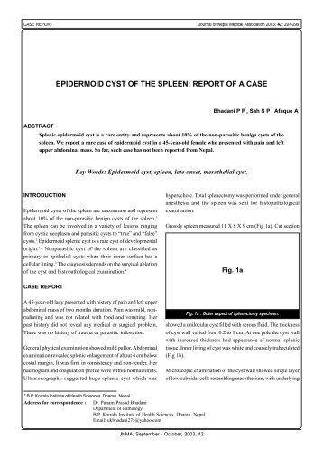 epidermoid cyst of the spleen - Journal of Nepal Medical Association