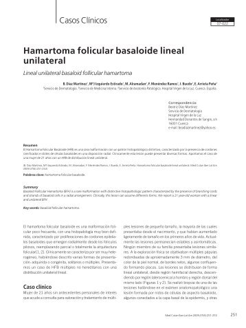 Hamartoma folicular basaloide lineal unilateral - edigraphic.com