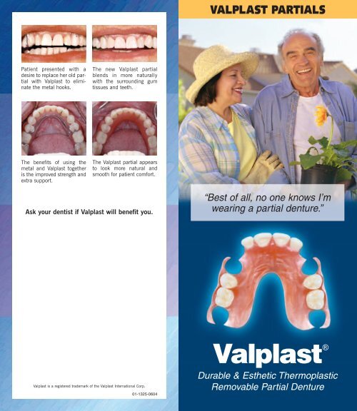 Valplast® - Glidewell Dental Lab