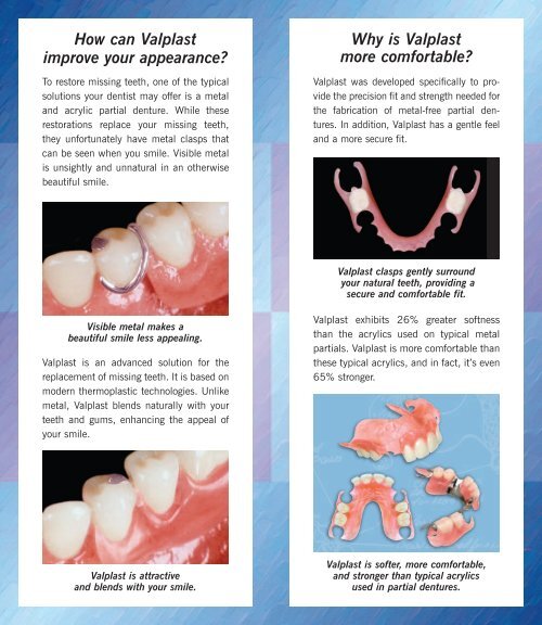 Valplast® - Glidewell Dental Lab