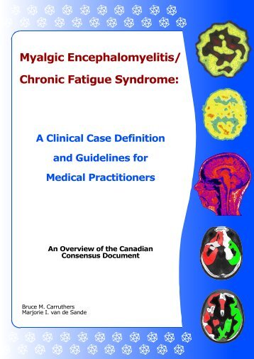 Myalgic Encephalomyelitis/Chronic Fatigue Syndrome - ME/CFS ...