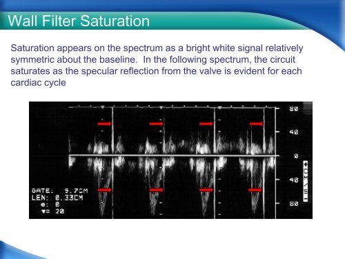 RPVI Exam Vascular Physics Case Review.pdf - VascularWeb