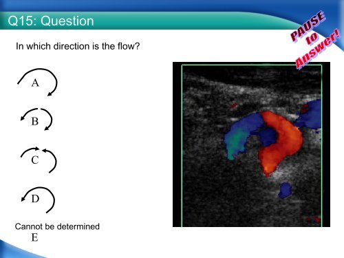 RPVI Exam Vascular Physics Case Review.pdf - VascularWeb