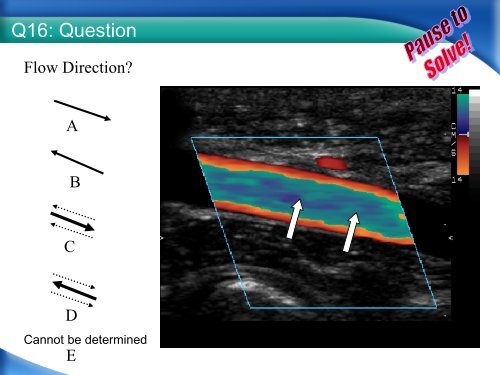 RPVI Exam Vascular Physics Case Review.pdf - VascularWeb