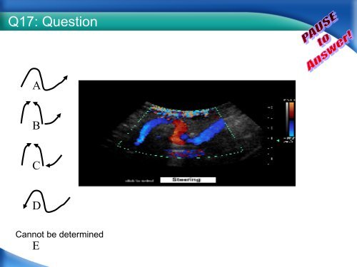 RPVI Exam Vascular Physics Case Review.pdf - VascularWeb