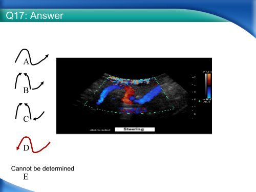 RPVI Exam Vascular Physics Case Review.pdf - VascularWeb