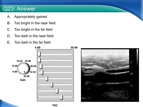 RPVI Exam Vascular Physics Case Review.pdf - VascularWeb