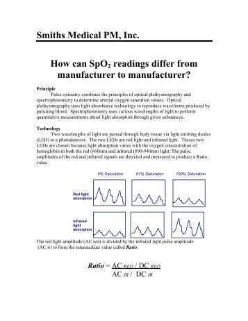 Can SP02 reading change - Mountainside Medical Equipment