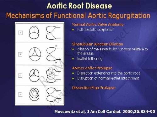 Dr Mohamad Ayman Abdel Hay Prof of ... - cardioegypt2011