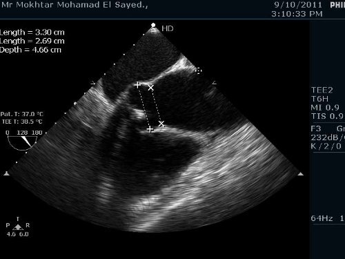 Dr Mohamad Ayman Abdel Hay Prof of ... - cardioegypt2011