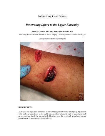 Penetrating Injury to the Upper Extremity - ePlasty