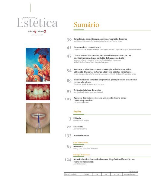 Revista Dental Press de EstÃ©tica V olume 4 - NÃºmero 2 - Abril / Maio ...