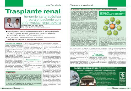 Trasplante renal - Tendencias en Medicina