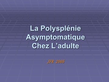 La PolysplÃ©nie Asymptomatique Chez L'adulte