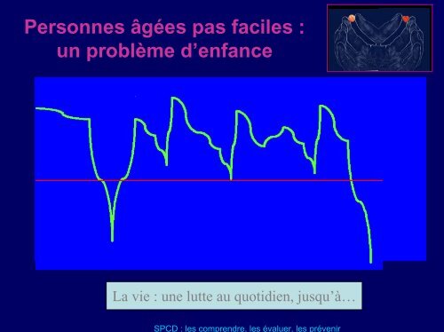 Diapositive 1 - Centre hospitalier Esquirol