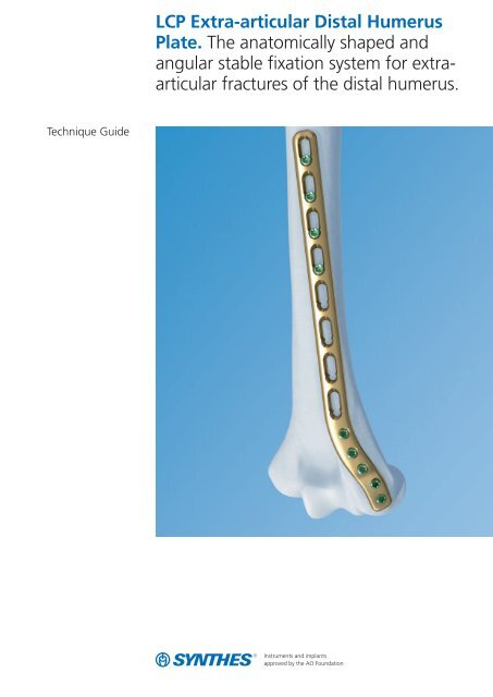 LCP Extra-articular Distal Humerus Plate. The anatomically shaped ...