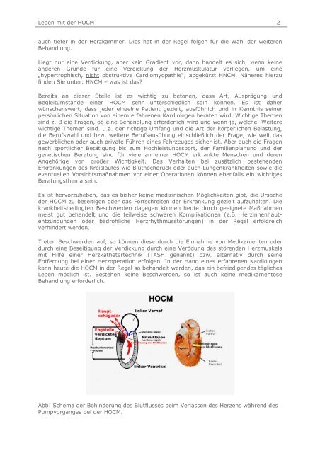 Das Leben mit der HOCM - theHeart.de