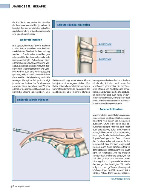 Die richtige Spritze zur richtigen Zeit - Orthopress