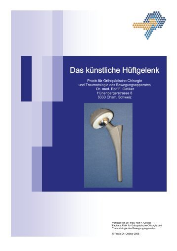 Das Künstliche Hüftgelenk printversion 1 - orthozentrum.ch