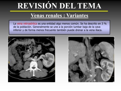 REVISIÓN DEL TEMA