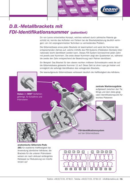 STEP-System - Dentalline