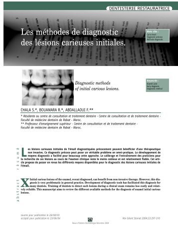 Les mÃ©thodes de diagnostic des lÃ©sions carieuses initiales. - SOP