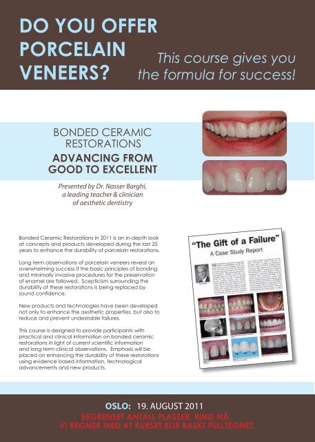 do you offer porcelain veneers? - Norsk Orthoform Depot AS