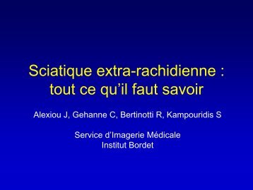 Sciatique extra-rachidienne : tout ce qu'il faut savoir