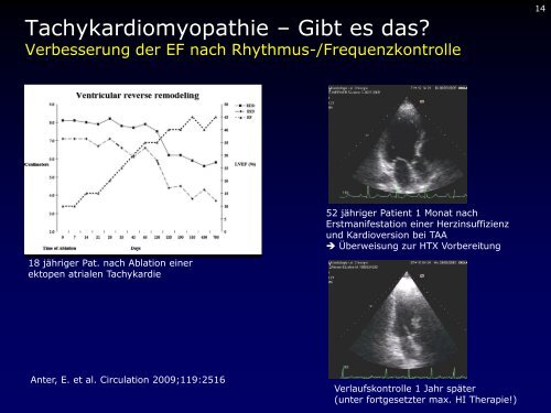 Dr. med. Breithardt - Kardioecho-Update 2013