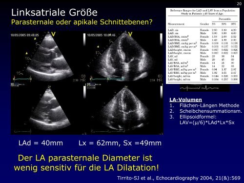 Dr. med. Breithardt - Kardioecho-Update 2013