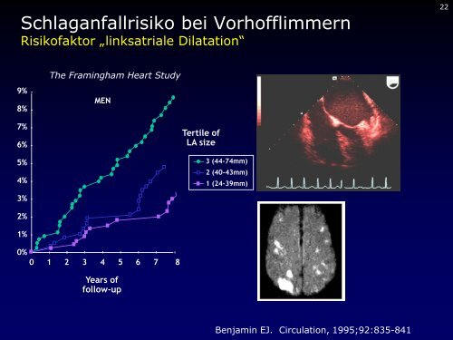 Dr. med. Breithardt - Kardioecho-Update 2013