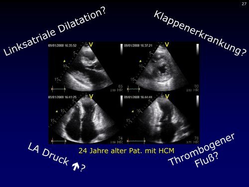 Dr. med. Breithardt - Kardioecho-Update 2013