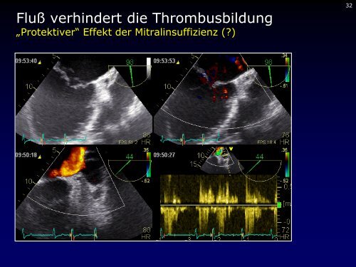 Dr. med. Breithardt - Kardioecho-Update 2013