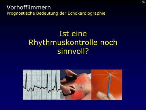 Dr. med. Breithardt - Kardioecho-Update 2013