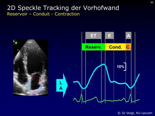 Dr. med. Breithardt - Kardioecho-Update 2013