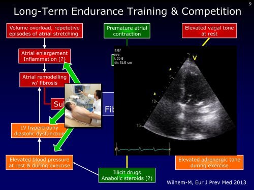 Dr. med. Breithardt - Kardioecho-Update 2013