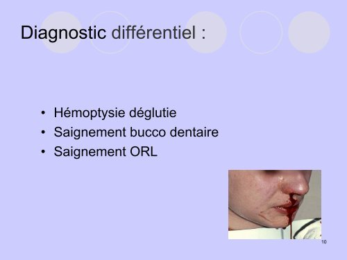 Conduite à tenir devant une hémorragie digestive ... - SMUR BMPM