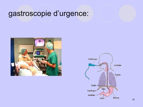 Conduite à tenir devant une hémorragie digestive ... - SMUR BMPM