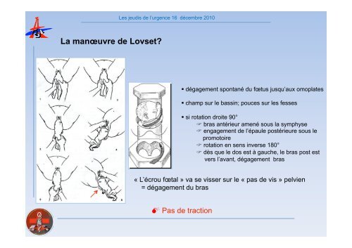 Accouchement dystocique - SMUR BMPM