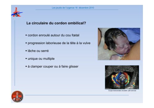 Accouchement dystocique - SMUR BMPM